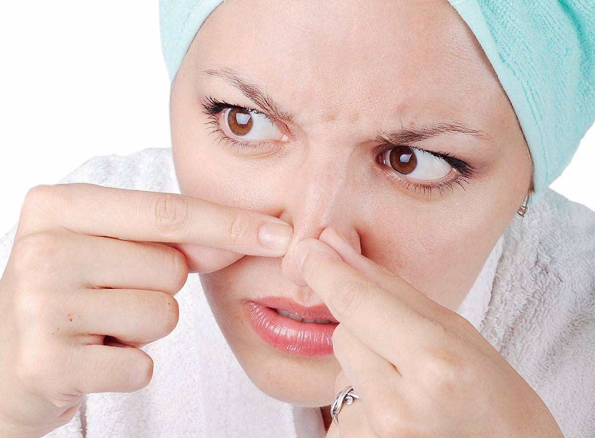 آیا جوشهای سرسیاه خودبهخود از بین میروند؟